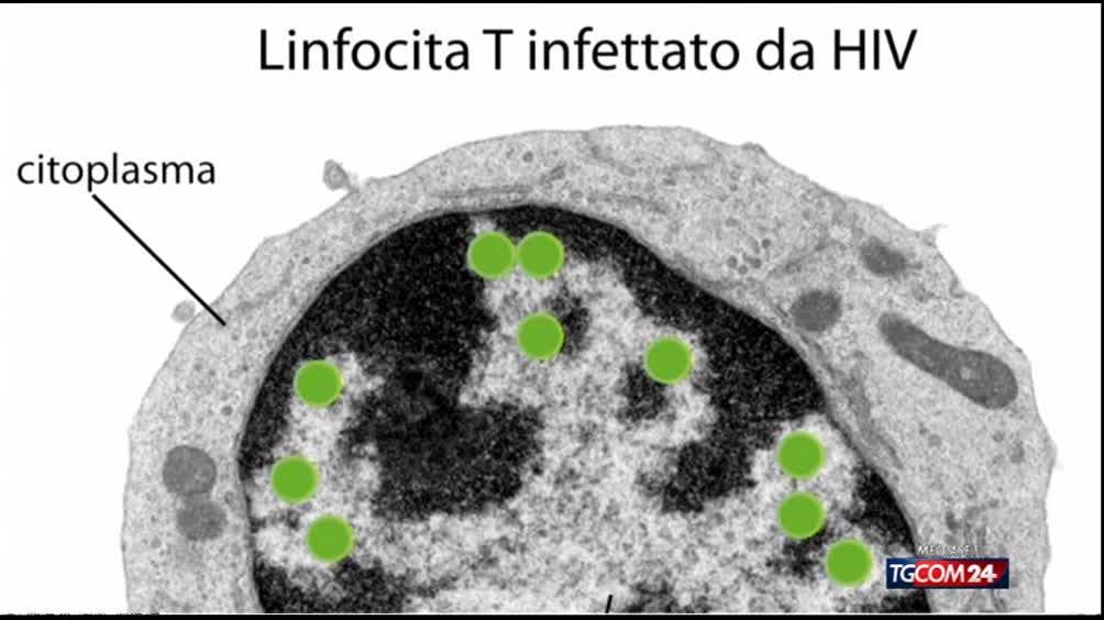 Hiv, la scoperta degli italiani Hiv, la scoperta degli italiani