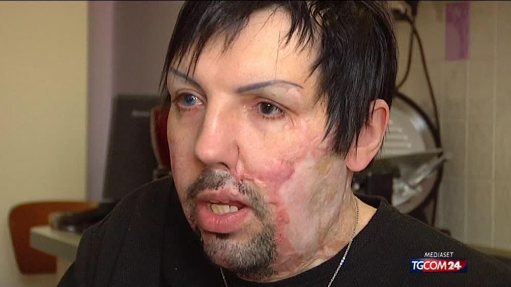 Sfregiato, il calvario di William